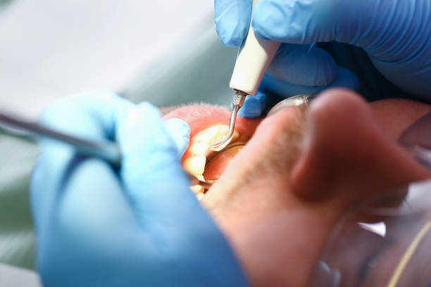 Best Emergency Treatment for Toothache in Shorewood Tower Hills Harbert, MI