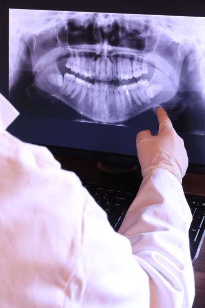 Best Emergency Tooth Extraction in Shorewood Tower Hills Harbert, MI