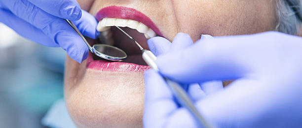 Best Emergency Dental Surgery in Shorewood Tower Hills Harbert, MI